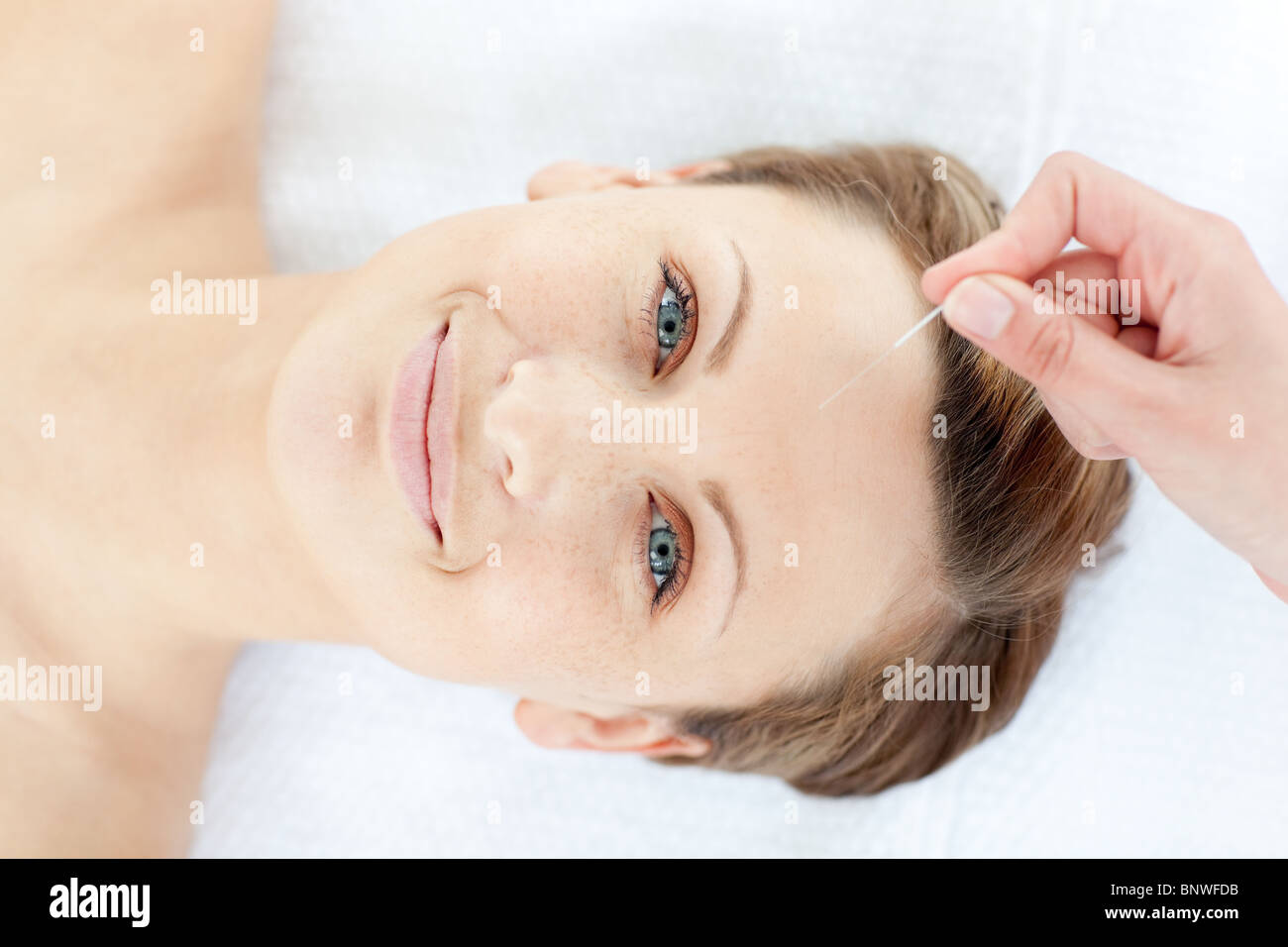 Porträt einer fröhlichen Frau in der Akupunkturtherapie Stockfoto