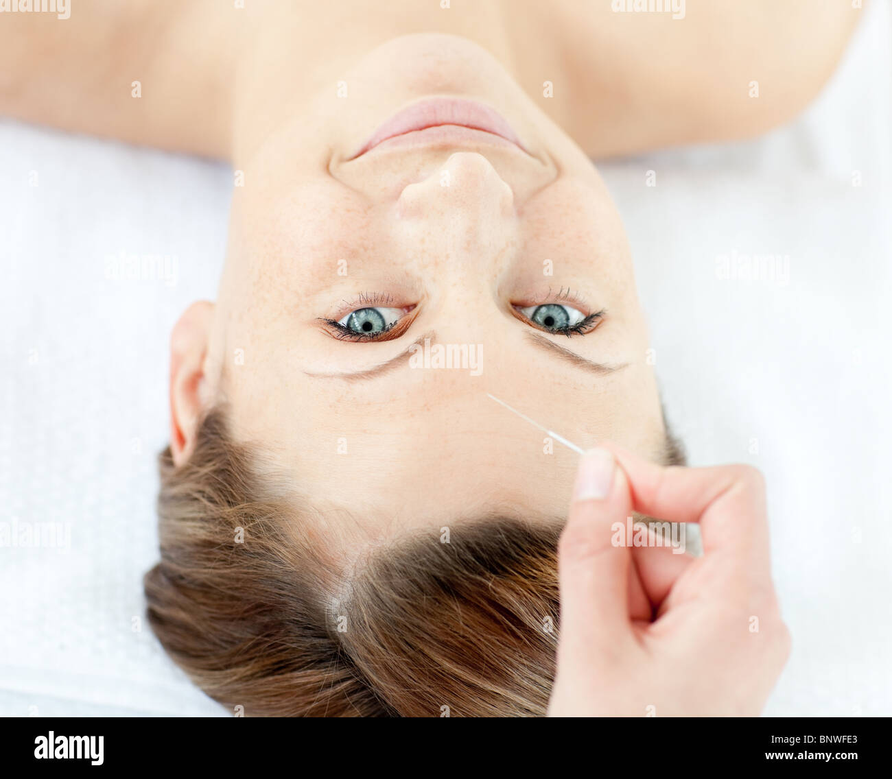 Akupunkturnadeln am Kopf einer schönen Frau Stockfoto