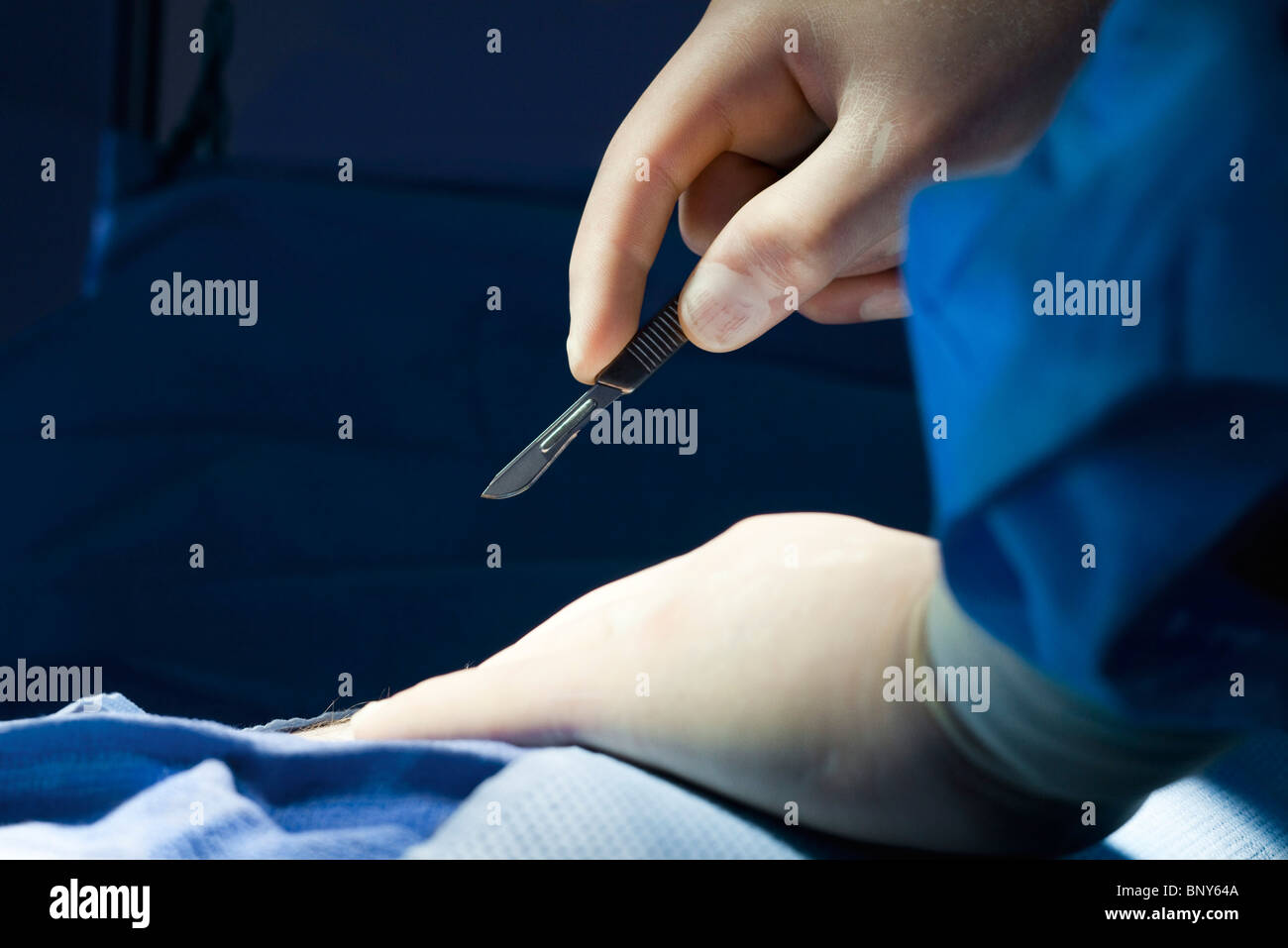 Chirurg Verfahren mit Skalpell in der hand beginnen, Nahaufnahme Stockfoto