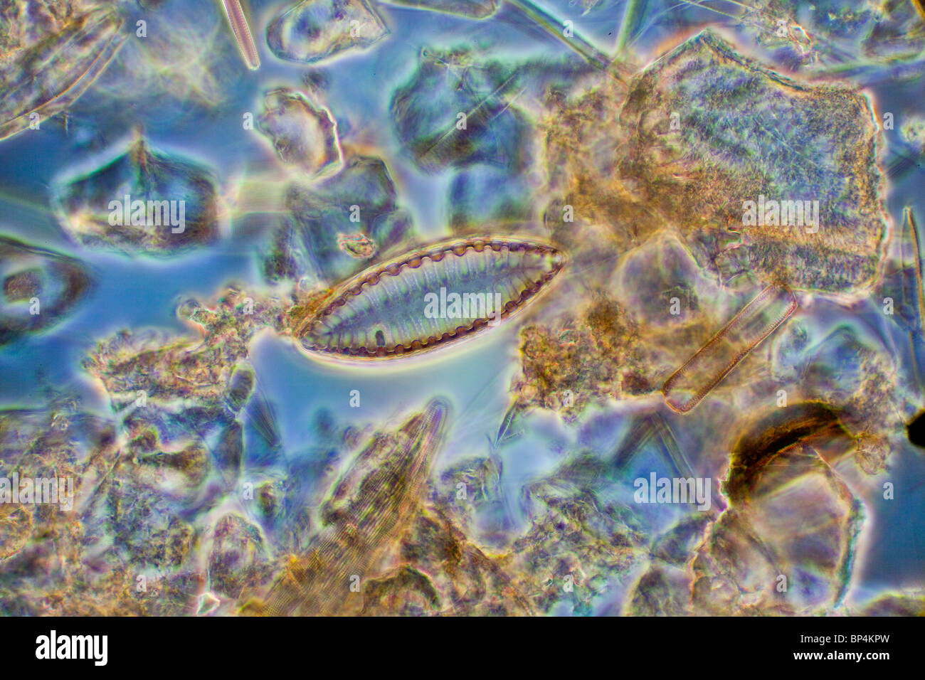 Dunkelfeld / phase Kontrast Mikrophotographie, Diatomee, Surirella Spp, Dinnington Teiche Wasserfall Stockfoto
