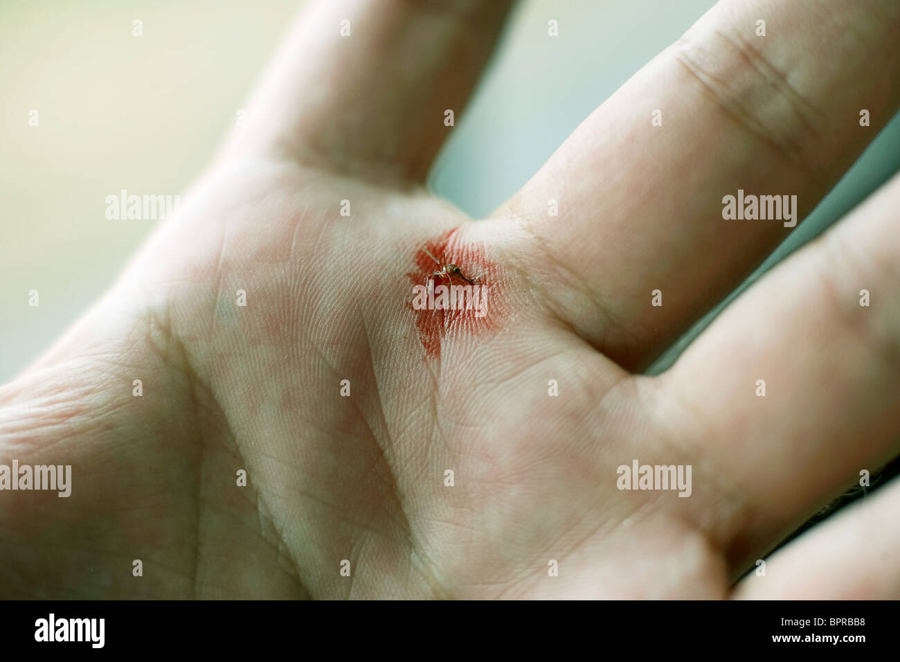 Detail von Hand nach der Zerkleinerung einer Blut gefüllten Mücke in Malawi. Stockfoto