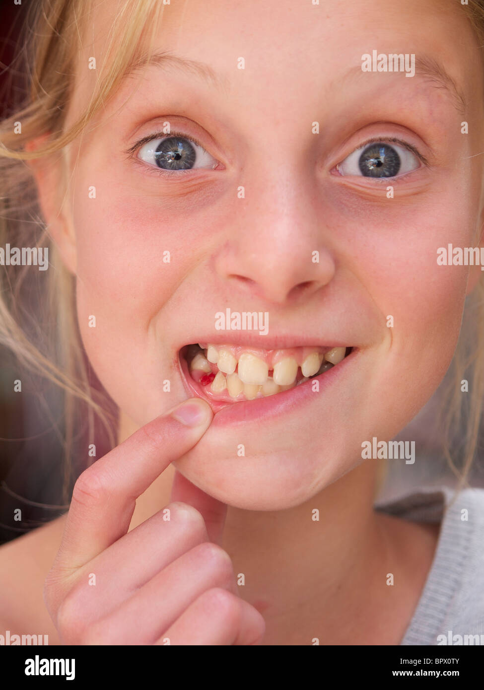 Mädchen zeigt ihre molare 10 Jahre alt, den Austausch von Zähnen Spaß lustig fehlt ihr Name ist Lara Stockfoto