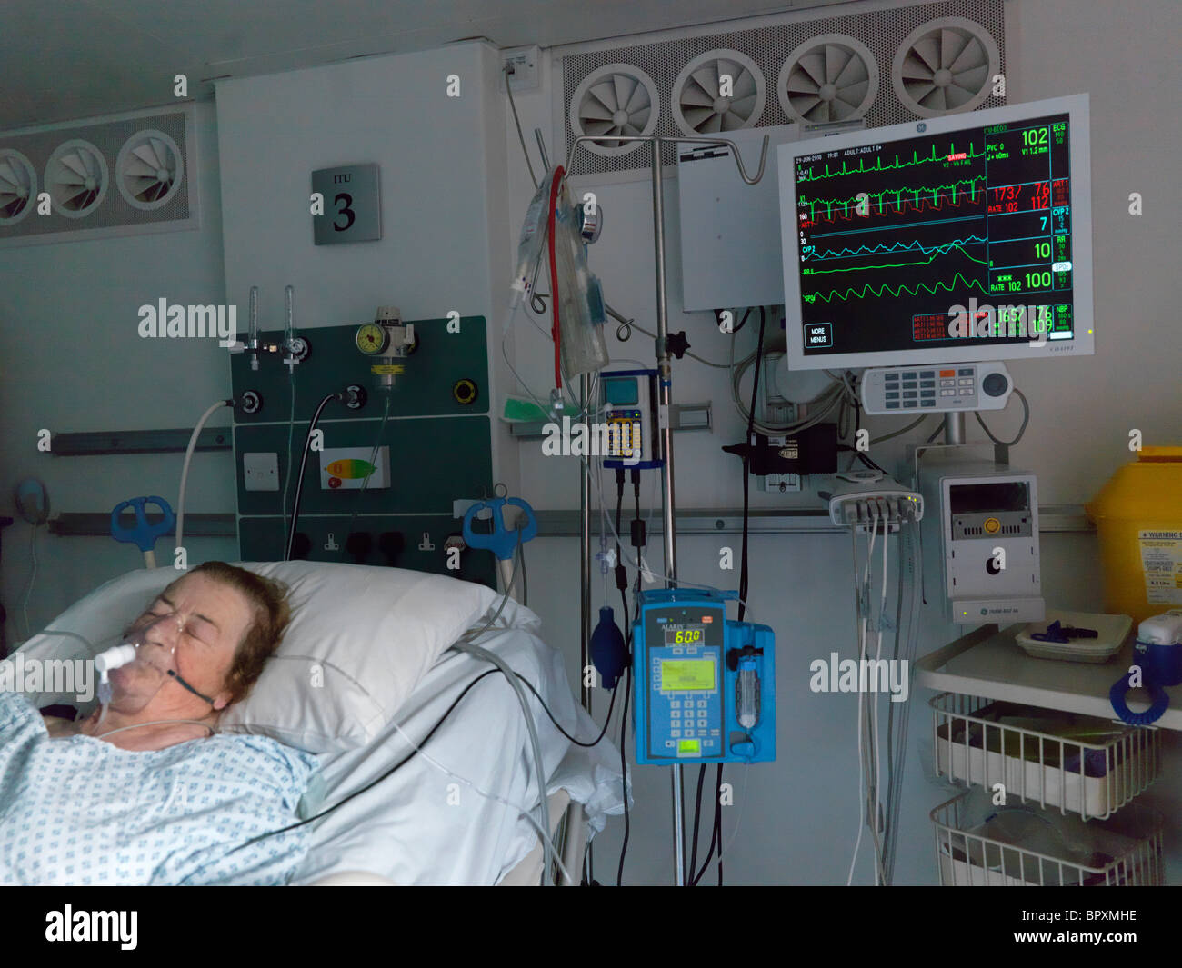 London England Private Intensivstation Seniorin im Krankenhausbett mit intravenösen Tropf und zeigt Herzfrequenz-Monitor Stockfoto