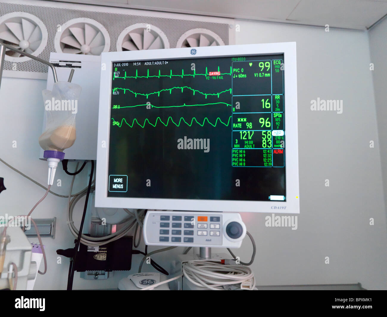 London England Intensive Care Unit Privatklinik Monitor zeigt Herzfrequenz Stockfoto