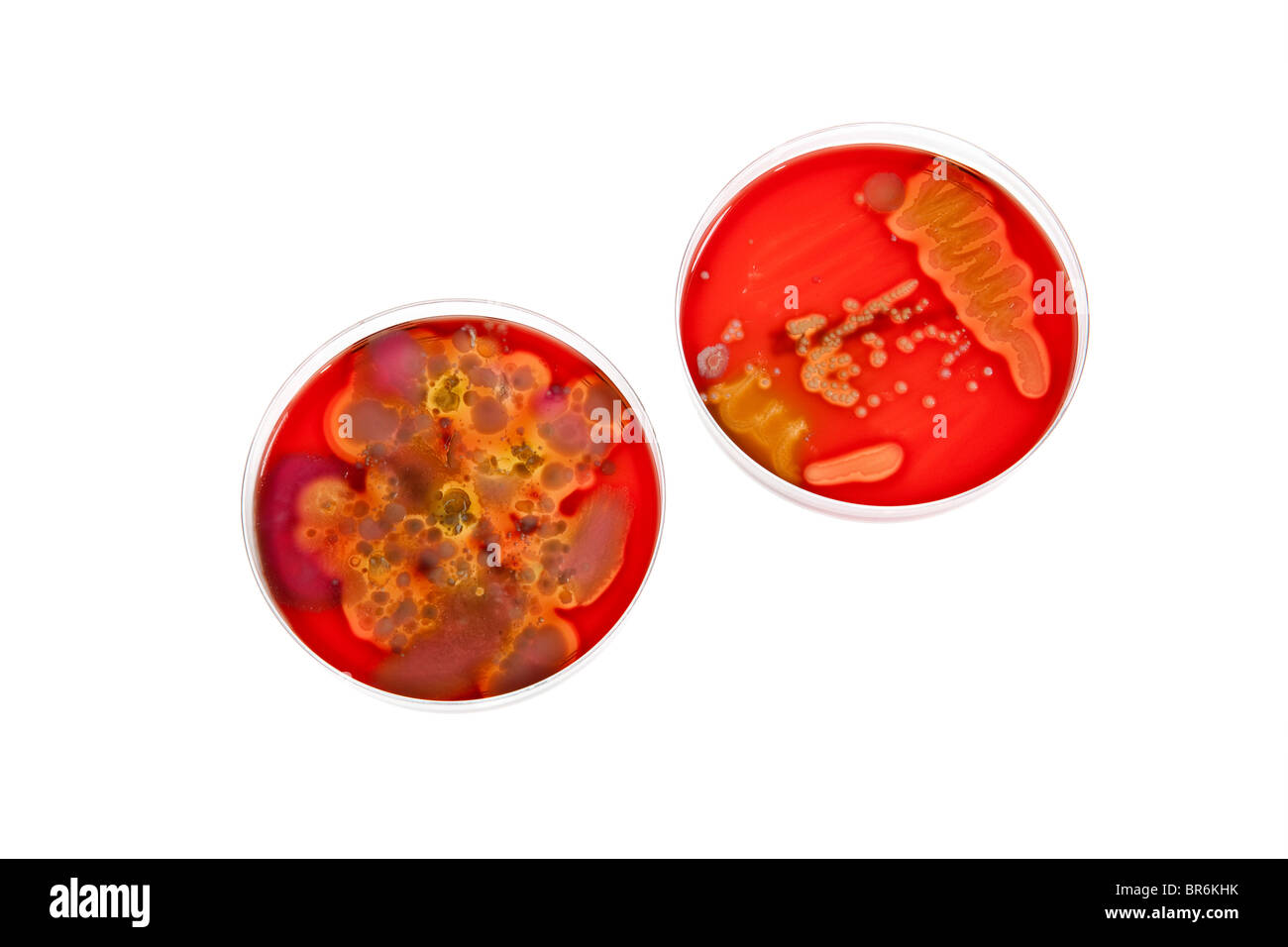 Petrischalen mit verschiedenen Stufen der Bakterien Kulturen Stockfoto