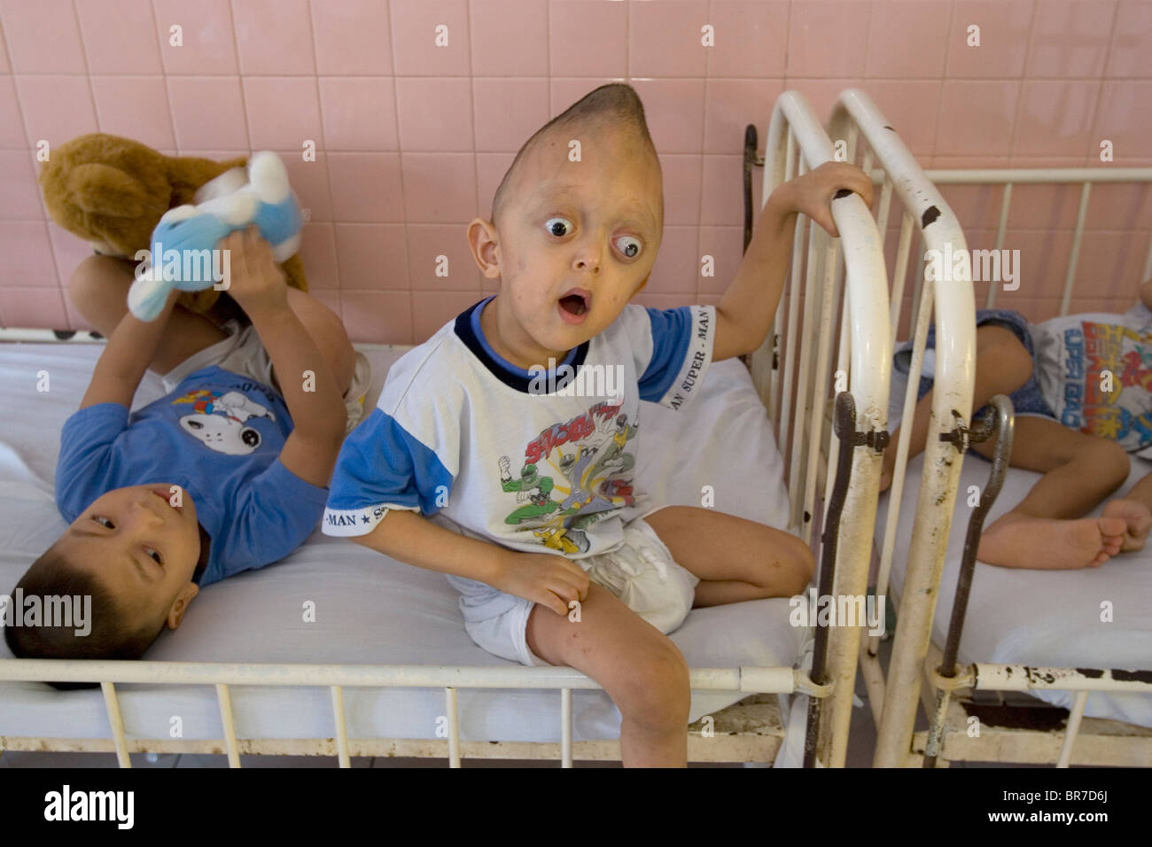 Agent Orange Opfer Stockfotos und -bilder Kaufen - Alamy