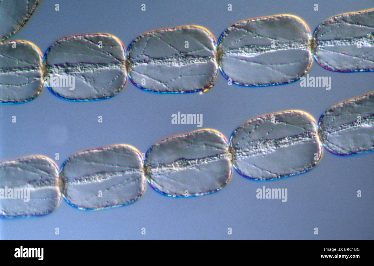 Leichte Schliffbild (LM) von Zellen aus einem Haar auf die Staubfäden der gemeinsamen Dreimasterblume (Tradescantia) Stockfoto