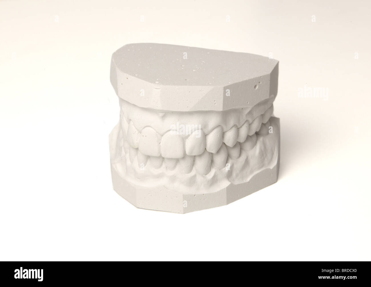 Ein Gipsabdruck von eine Reihe von Zähnen. Alle auf weißem Hintergrund. Stockfoto