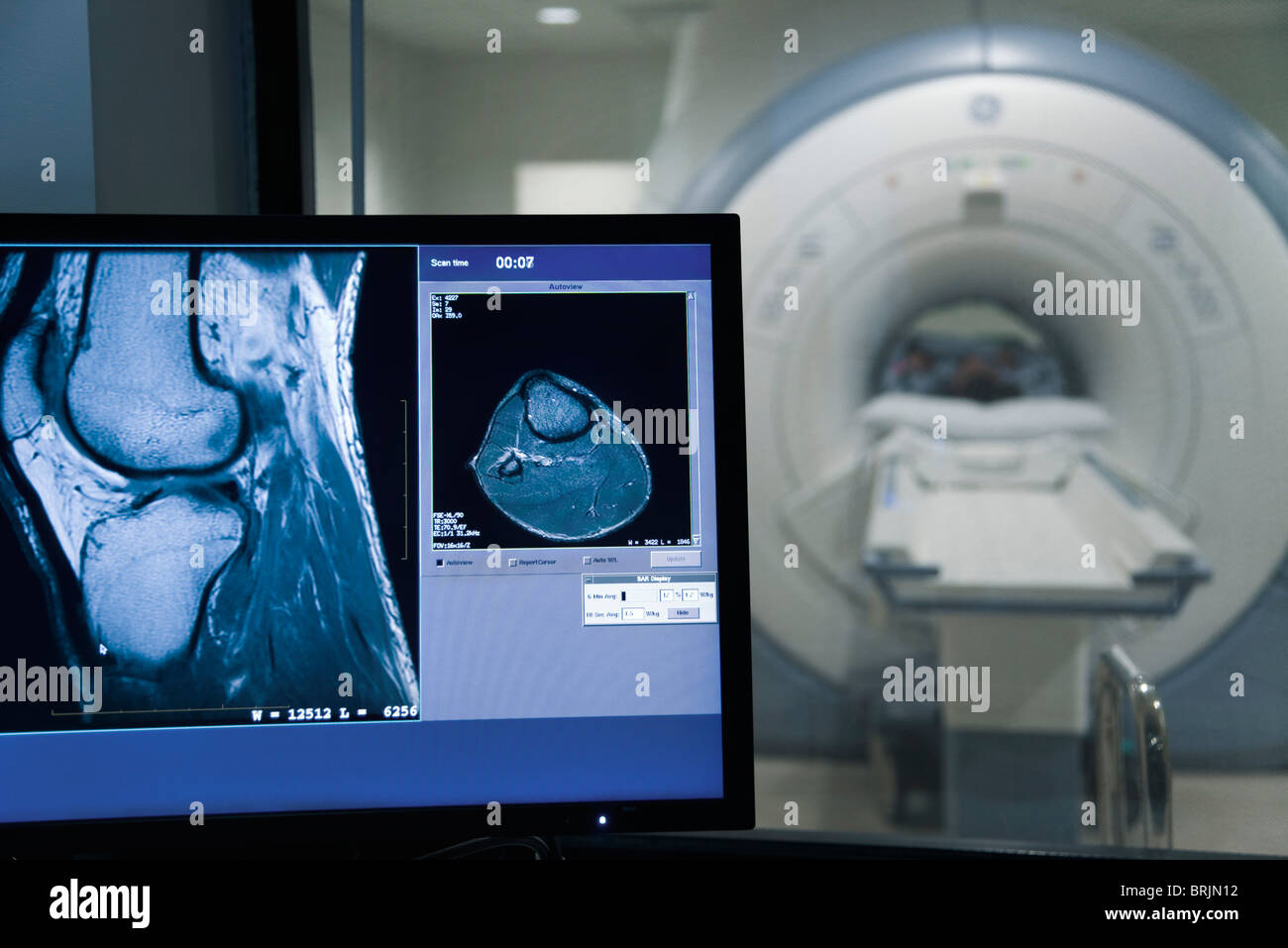 MRI scan-Ergebnis auf Computer-monitor Stockfoto