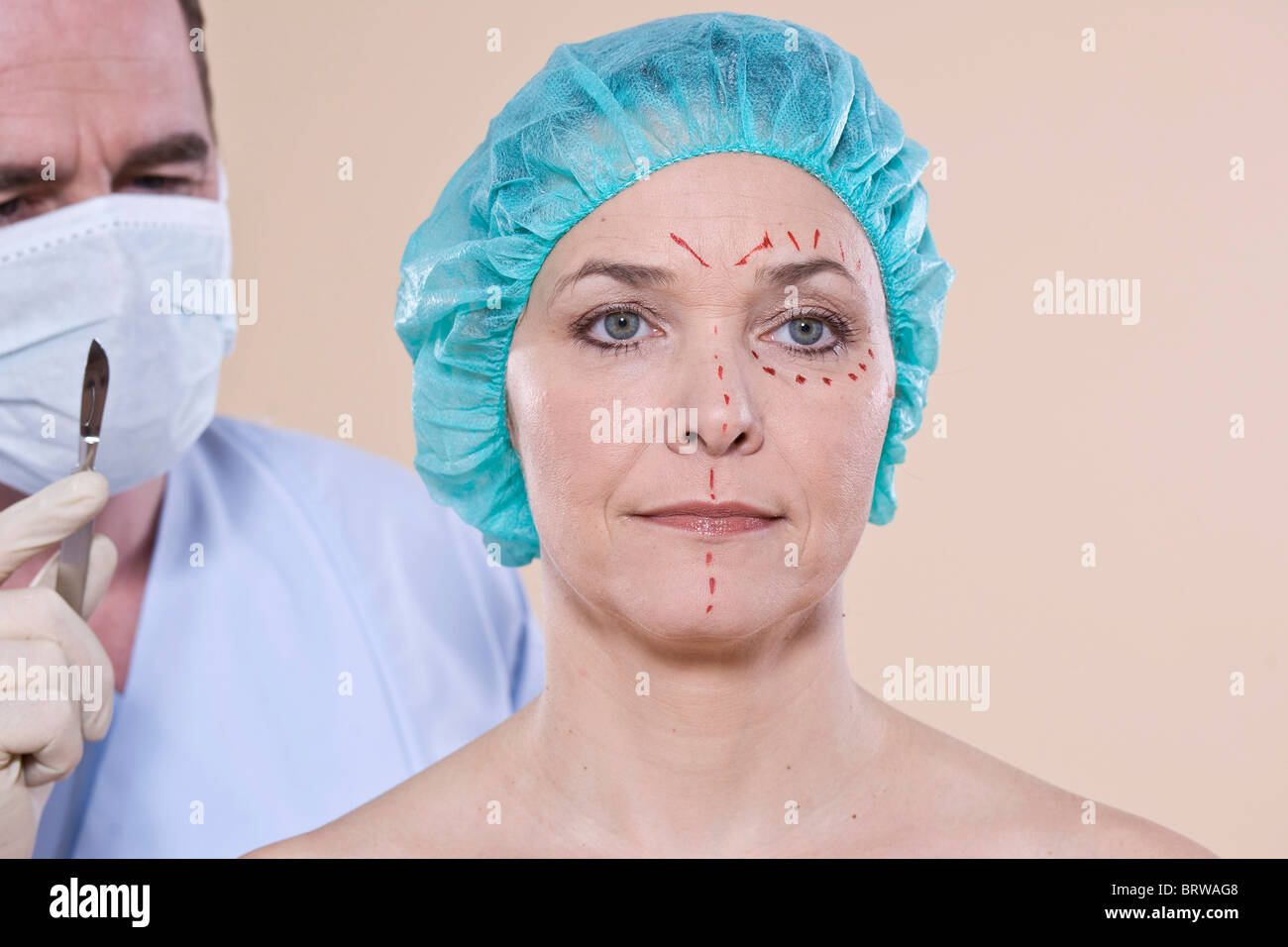 Porträt einer Frau mit Linien auf ihrem Gesicht für eine kosmetische Operation Stockfoto