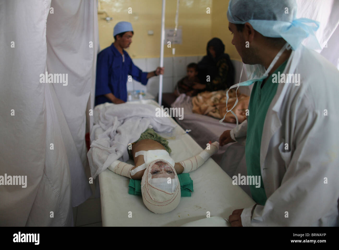 Verbrennungsopfer von einem IED-Anschlag in Afghanistan Stockfoto