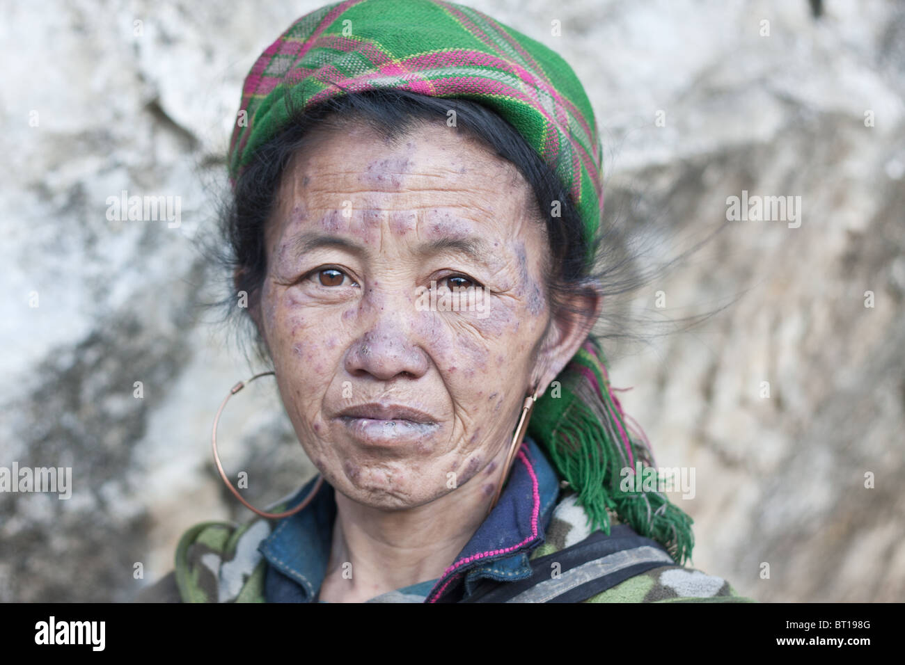 Opiumsuchtiger Stockfotos Und Bilder Kaufen Alamy
