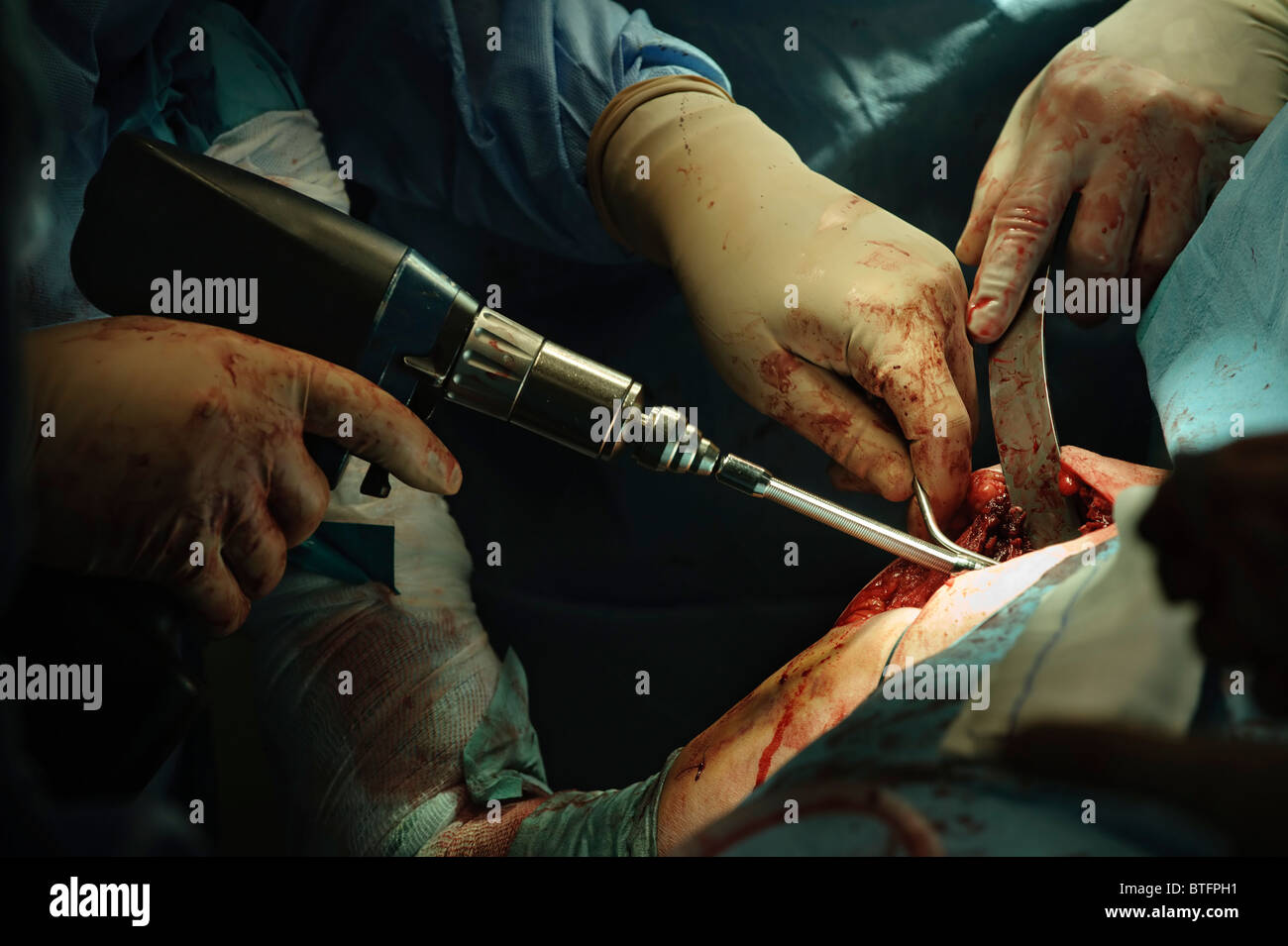 Ärzte Orthopädie im OP-Saal Stockfoto