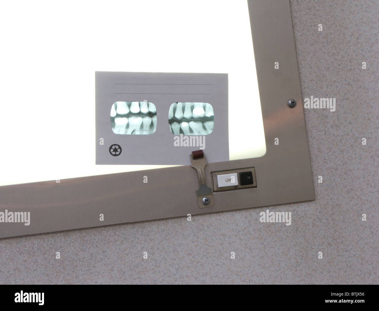 Nahaufnahme von Zahnröntgen im Untersuchungsraum Stockfoto