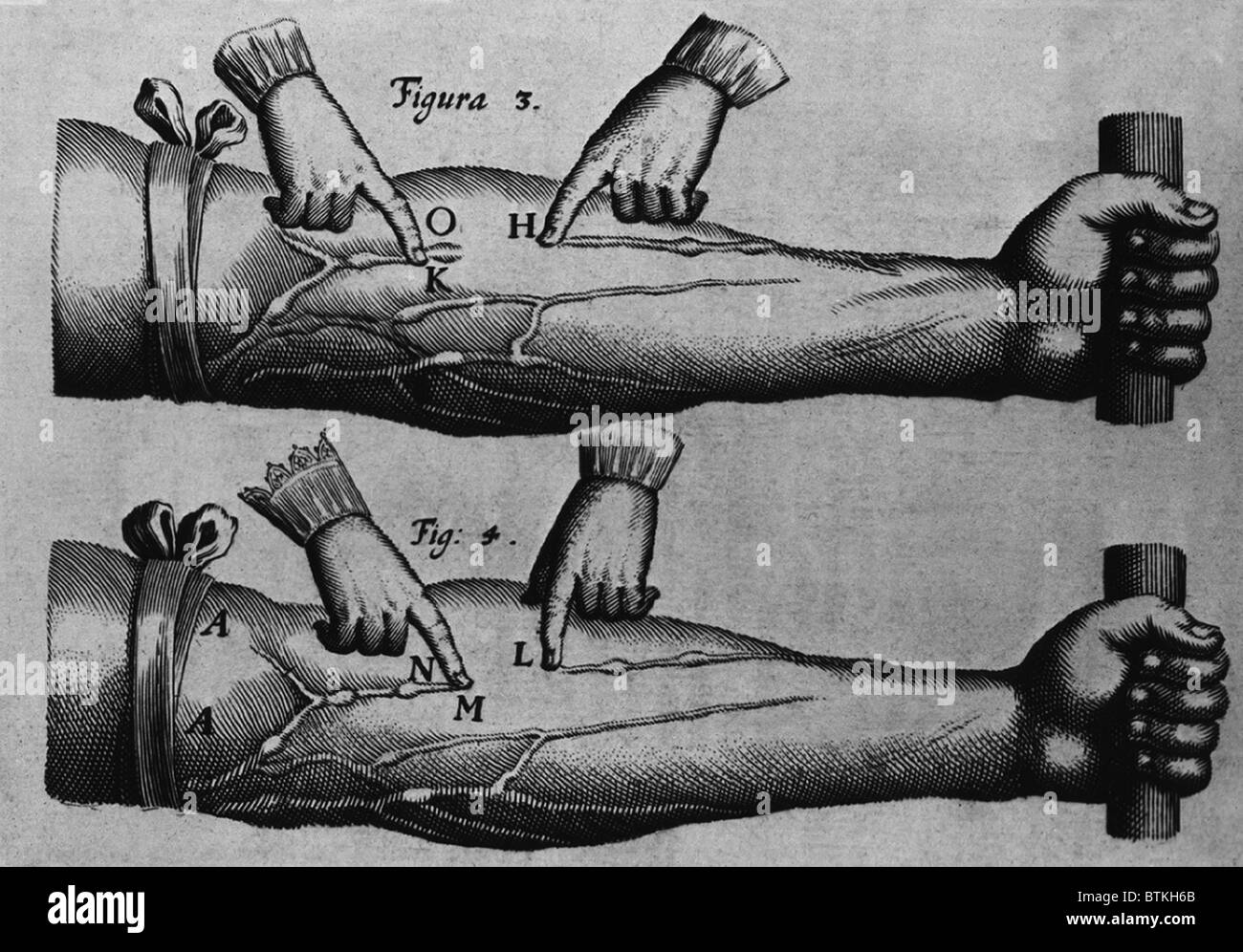 Zirkulation des Bluts von William Harvey ON THE Bewegungen vom Herz und Blut, 1628. Illustrationen von ein tourniqueted menschlicher Unterarme mit ausgeprägten oberflächlichen Adern Kreislauf an. Abb. 3: Blutfluss wird an zwei Punkten, O und H. blockiert. O das Blut bündelt in einem Ventil und nicht gegen die Hand, sondern fließt in Richtung Herz fließt. Abb. 4: Blutfluss wird an zwei Punkten, M und N, mit kein Ventil im Abschnitt blockiert. Stockfoto