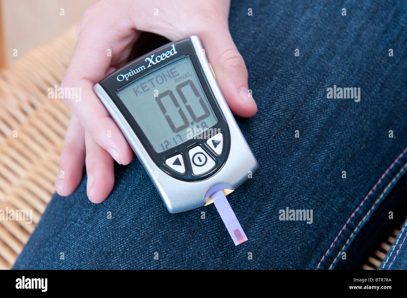 Junger Mensch macht einen Blutzucker-Test für Diabetes und die Überprüfung des Monitors lesen Stockfoto