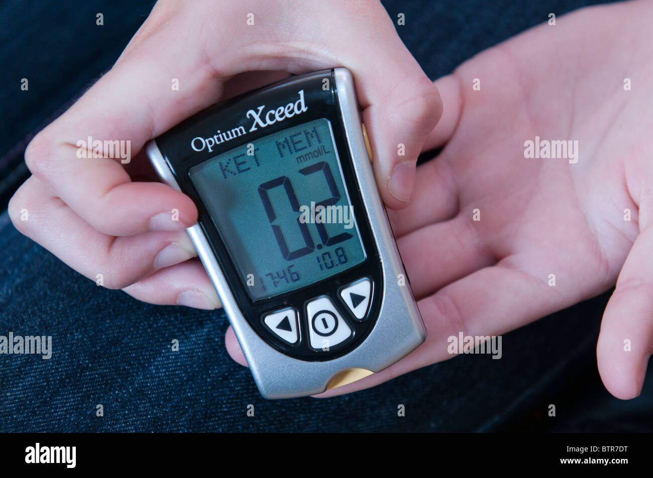 Junge Person, die einen Blutzucker test für Diabetes und Überprüfung des Monitors lesen, was zeigt, dass Ketone vorhanden sind Stockfoto
