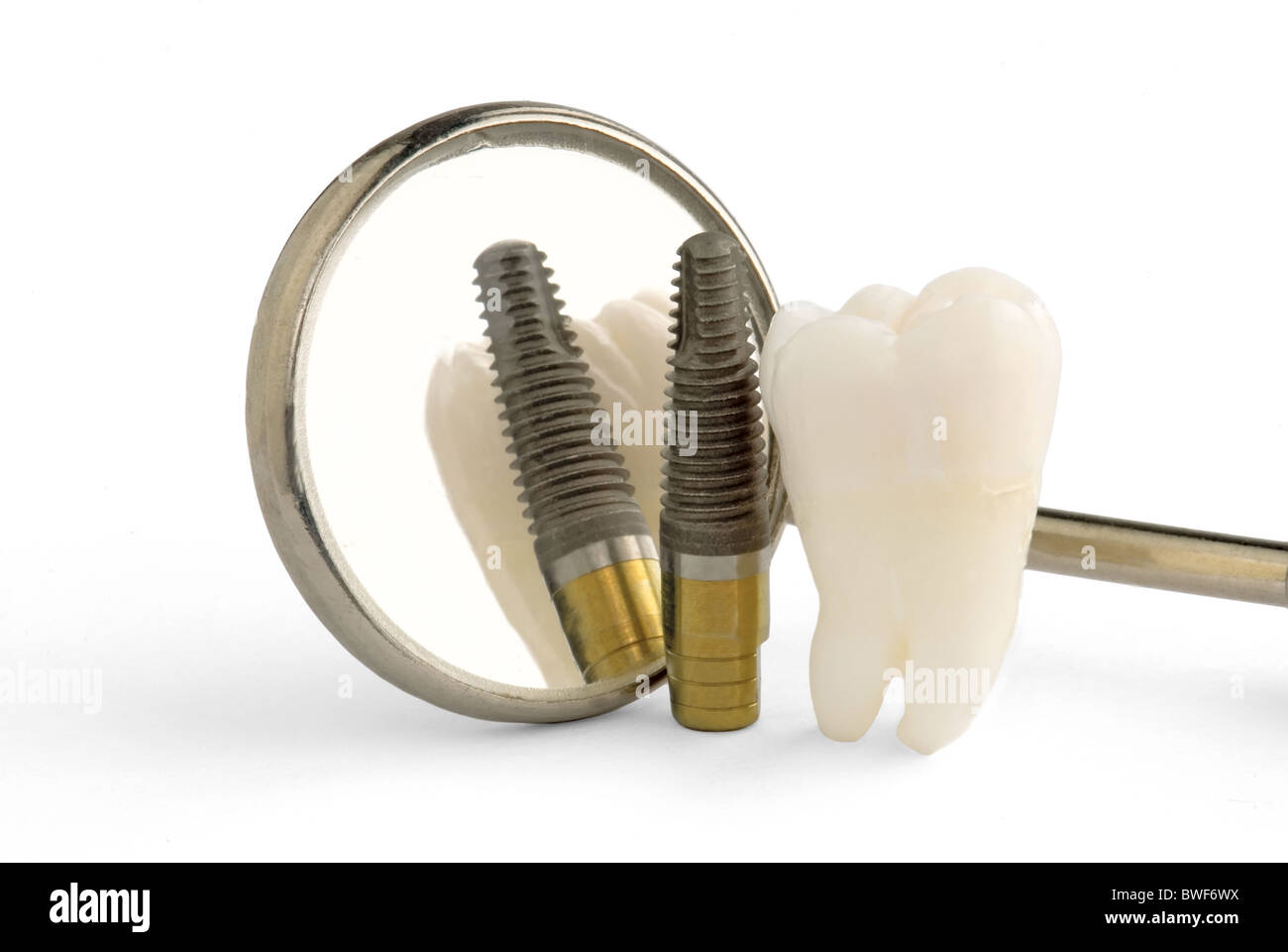 Echte menschliche Weisheitszahn und Zahnimplantaten Stockfoto