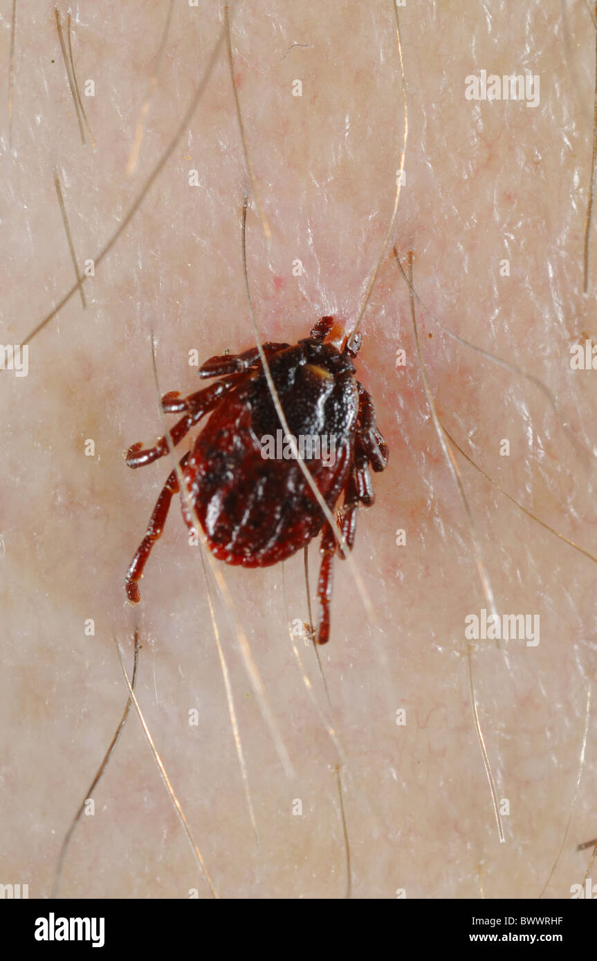 Ixodes Ricinus kreuzen Parasit menschliche Parasiten Krankheit Tier Zecken Zecken Parasiten Parasiten parasitäre Arachnid Spinnentiere Stockfoto