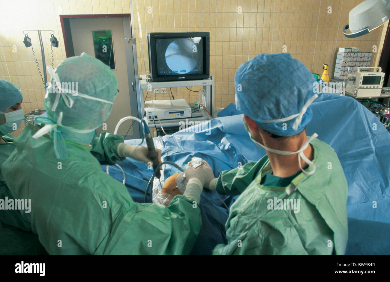 Ärzte Gesundheit Krankenhaus Knie Knie Gelenkoperation Medizin Monitor OP Operation Reflexion OP-team Stockfoto