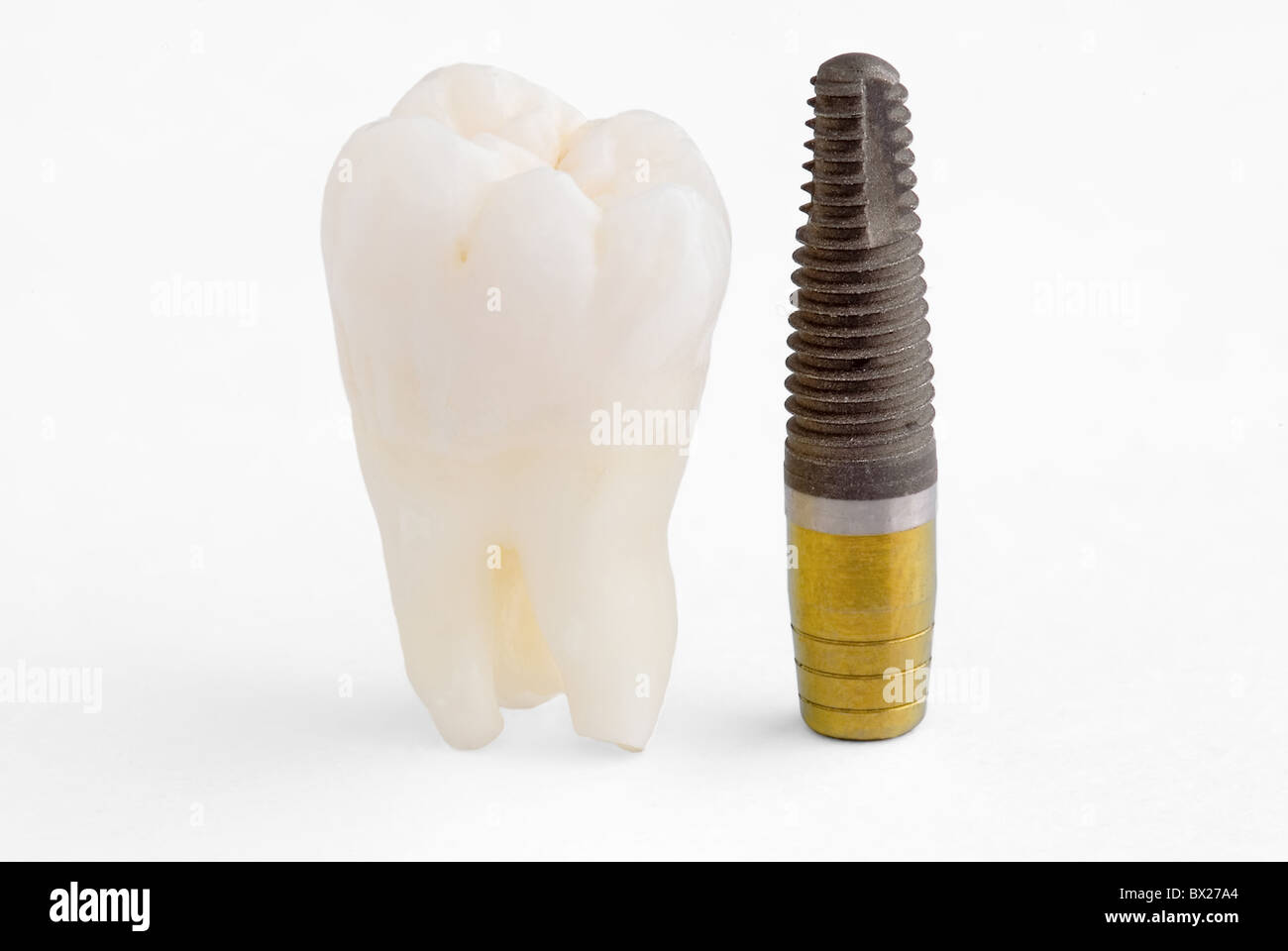 Echte menschliche Weisheitszahn und Zahnimplantaten Stockfoto