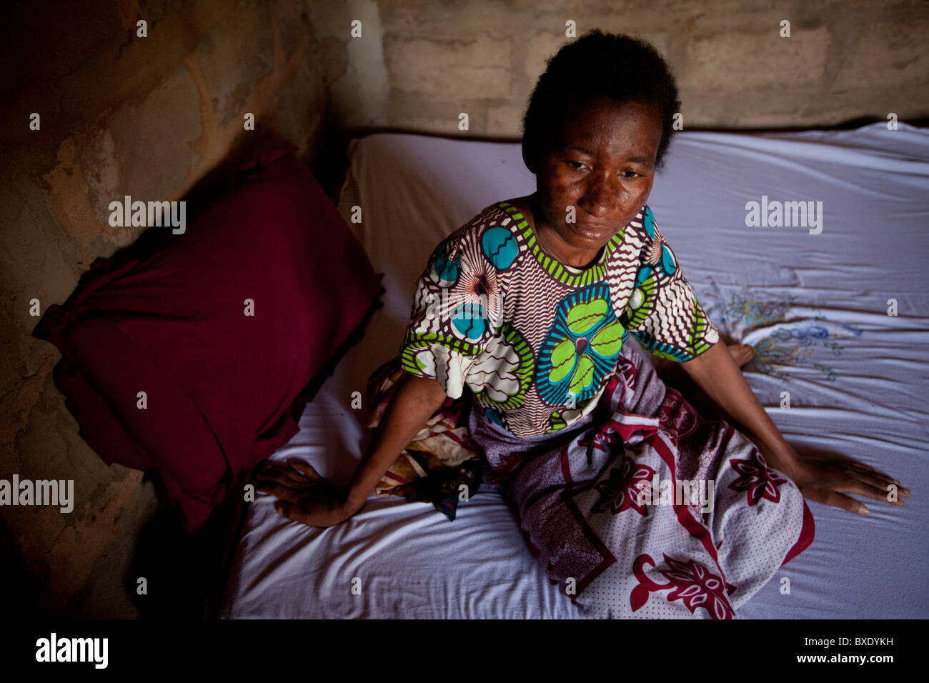 Frau Asha Mahammed (38), eine Frau Tuberkulosekranke, sitzt in ihrem Bett in Dar Es Salaam, Tansania, Ostafrika. Stockfoto