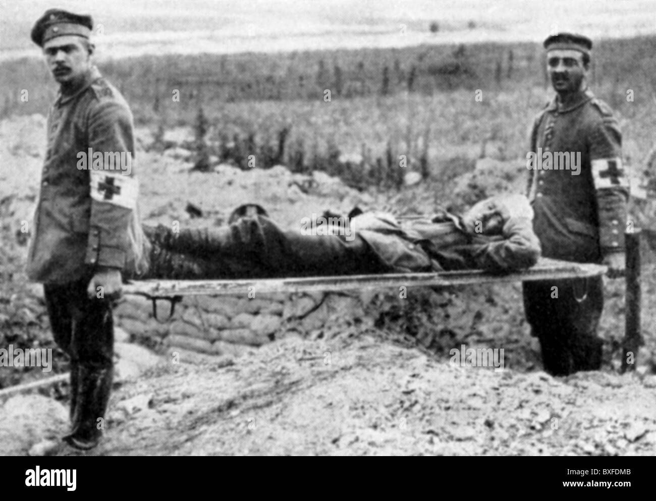 Veranstaltungen, erster Weltkrieg / 1. Weltkrieg, medizinischer Dienst, 1914 - 1918, Zusatz-Rechte-Clearences-nicht vorhanden Stockfoto