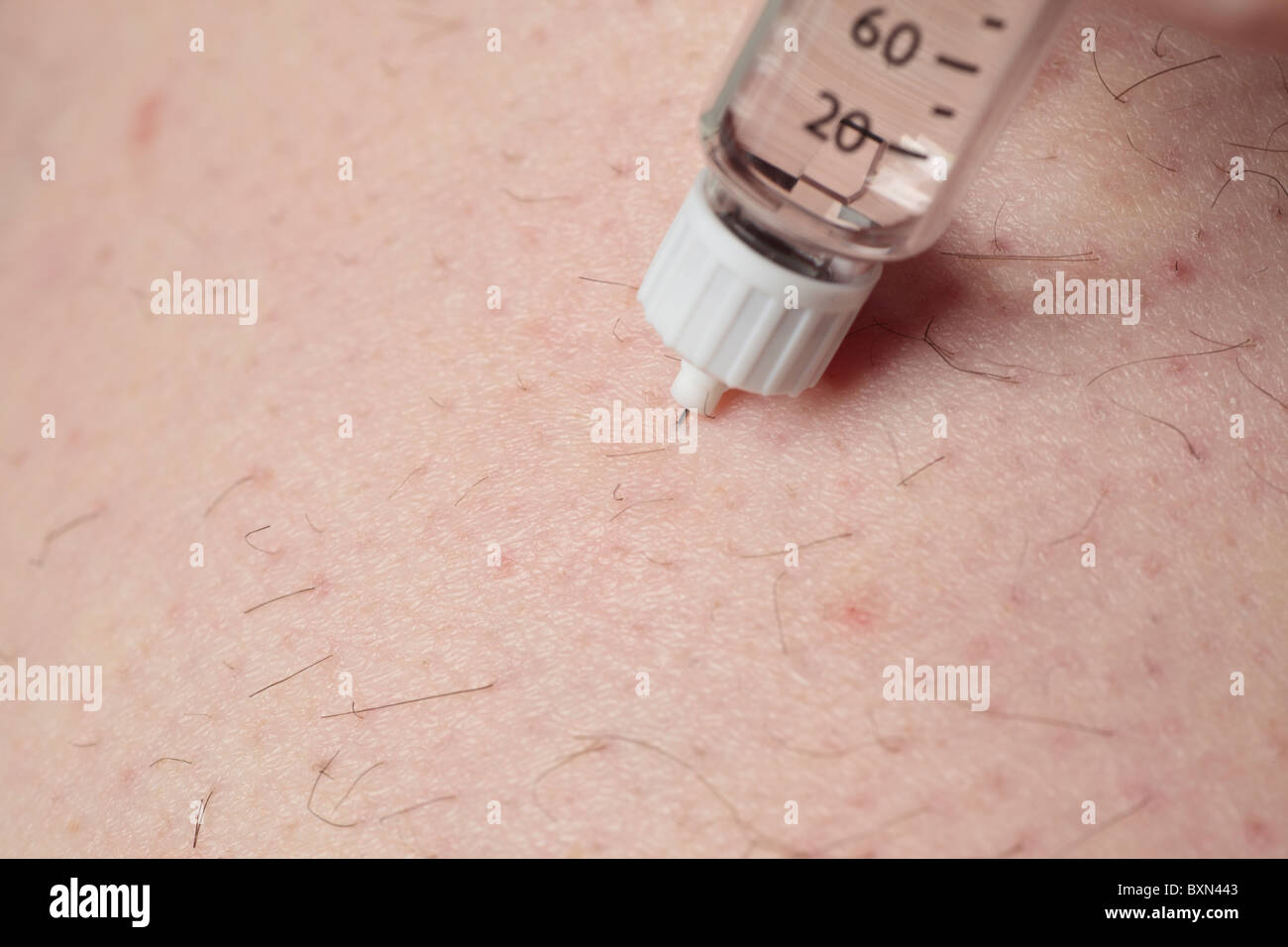 Insulininjektion. Stockfoto