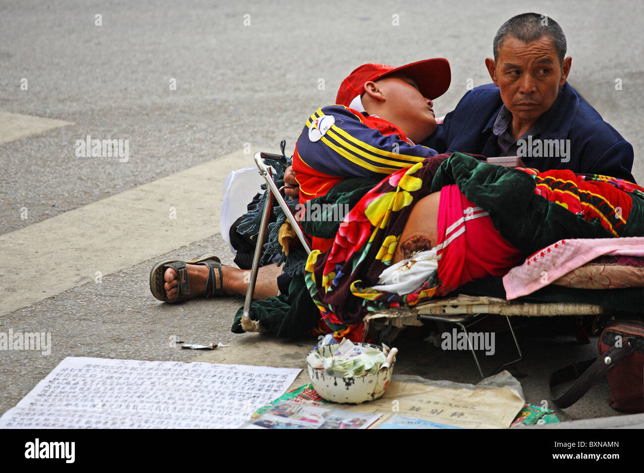 Person mit klaffenden Fleischwunde liegen auf der Straße von Kunming, China Stockfoto