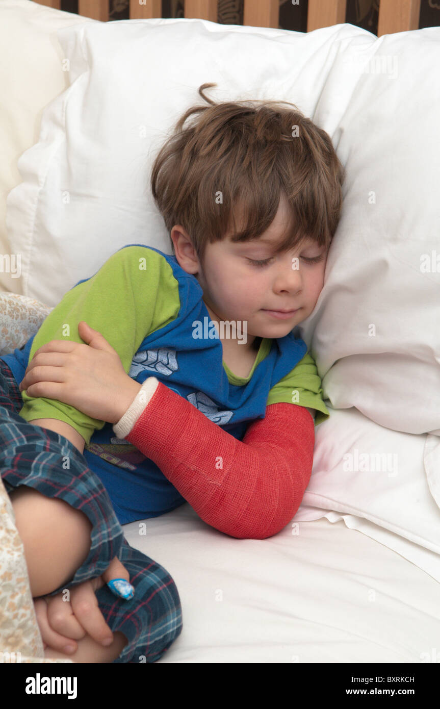 Vier Jahre alten Jungen mit gebrochenen Arm im Bett. rot Gips. Stockfoto