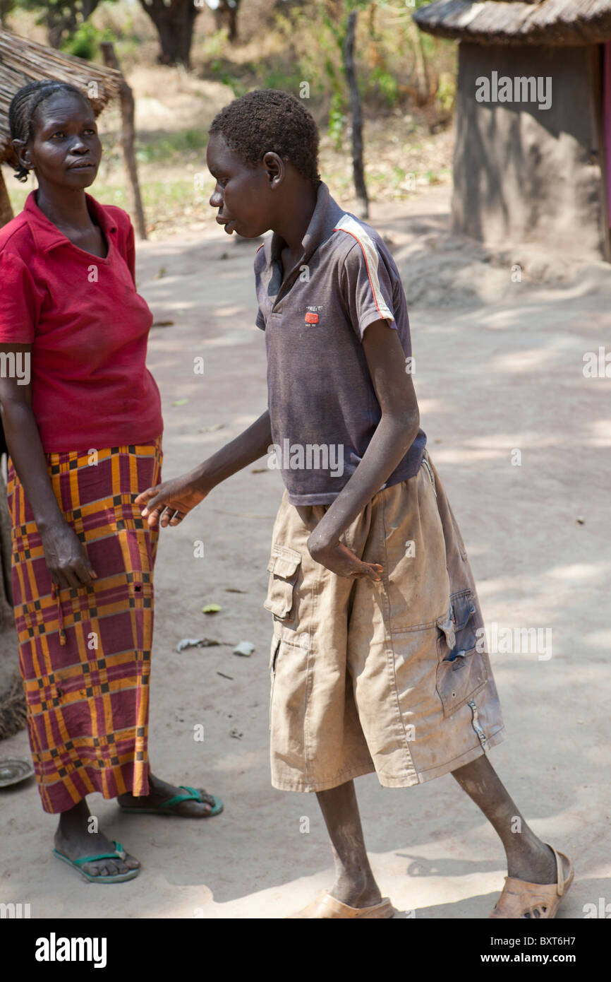 Nickend Krankheit, einer unheilbaren degenerativen Gehirnerkrankungen, Angriffe Kinder und Jugendliche - 30 Kinder im Flüchtlingslager Jambo habs. Stockfoto