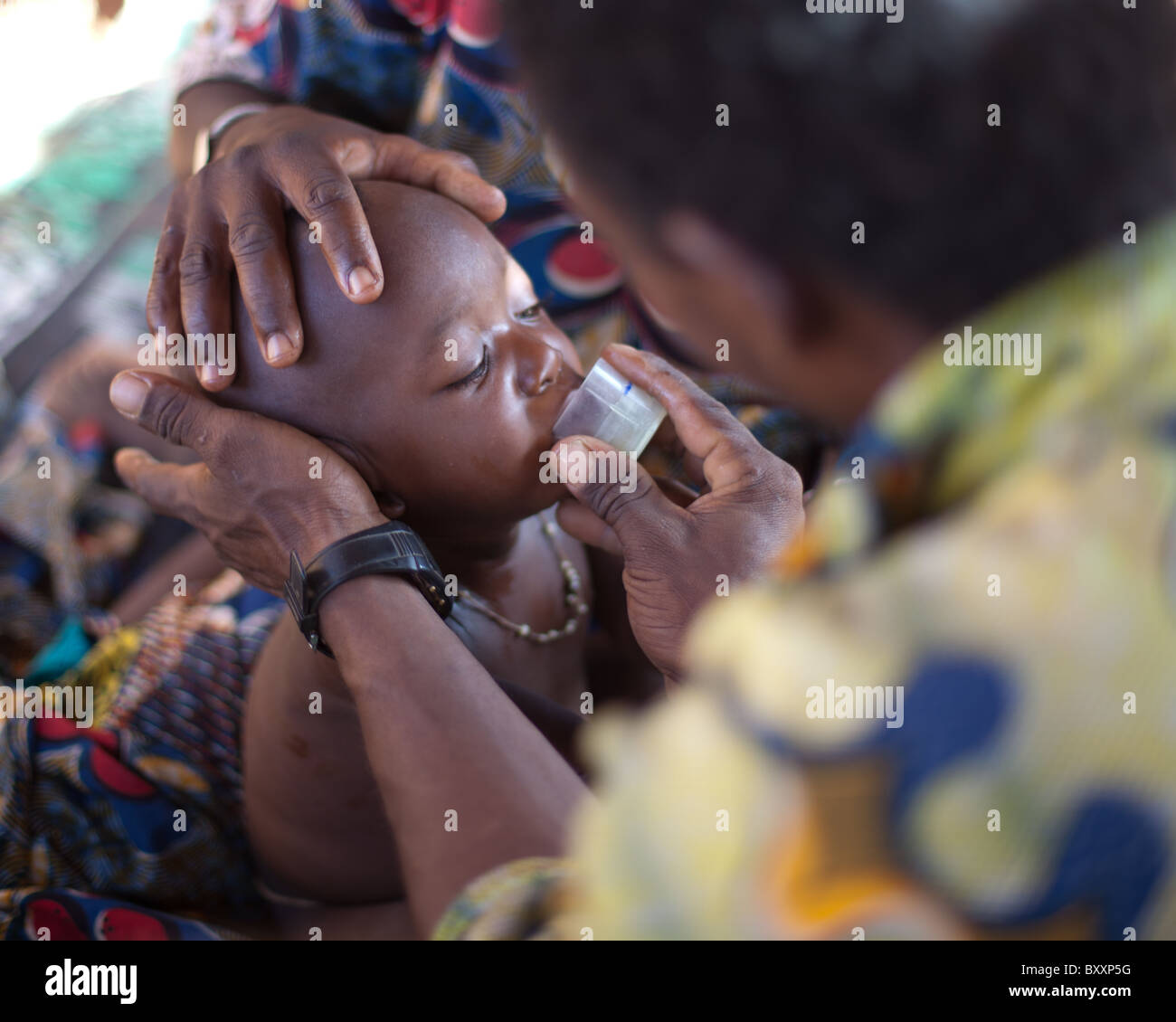 Ein Kind an Malaria in Burkina Artesunat und Amodiaquine, Artemisin-Kombinationstherapie für Malaria-Behandlung gegeben. Stockfoto