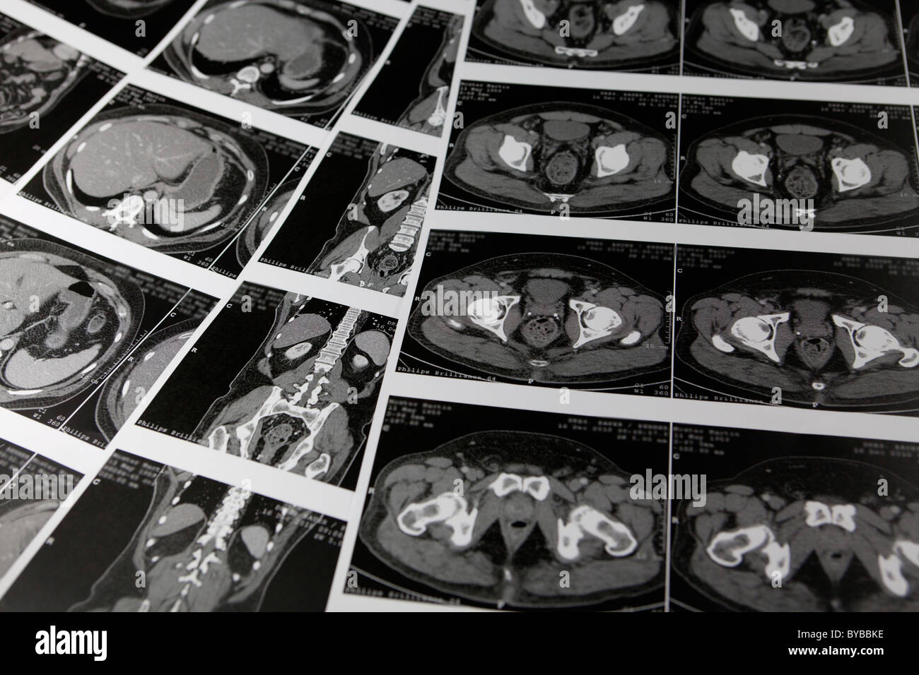 Mehrschicht berechnet, Computertomographie, Magnetresonanztomographie, MRT-Untersuchung der inneren Organe Stockfoto