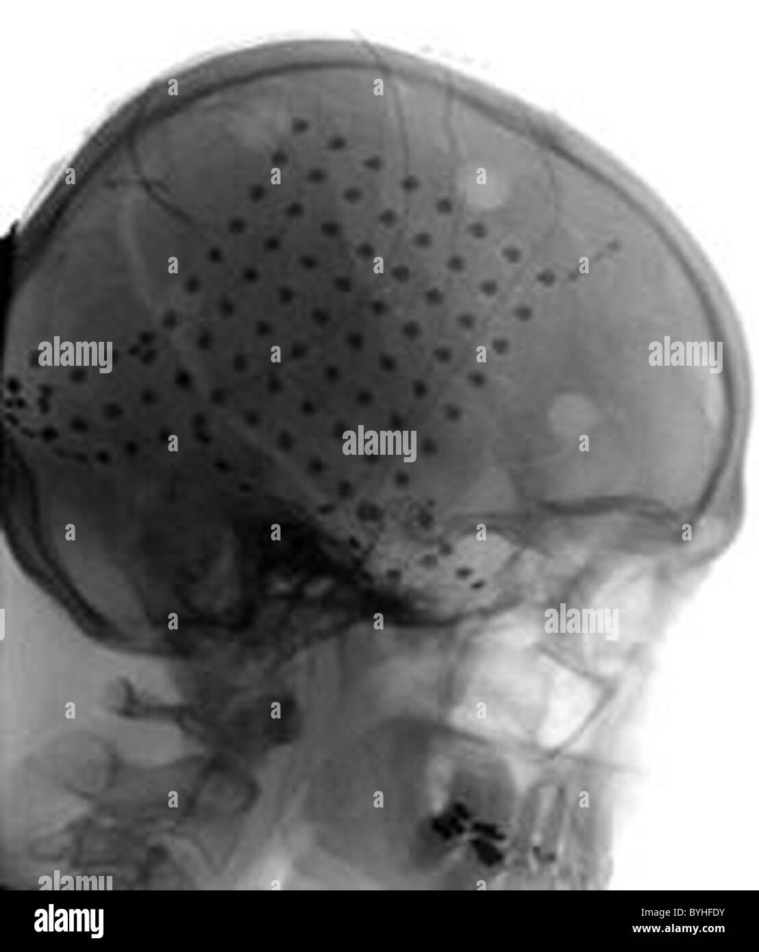 BRAIN COMPUTER verknüpfen die direkte Verbindung zwischen dem menschlichen Gehirn und einem Computer, einem sogenannten Brain-Computer Interface (BCI), Stockfoto