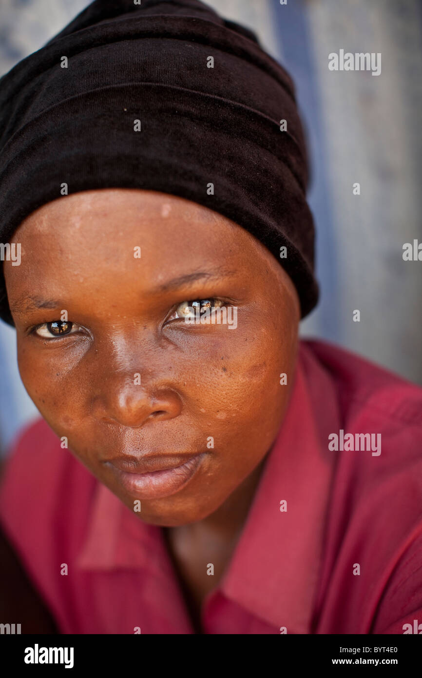 Eine HIV positiven Frau lebt in Kampala, Uganda, Ostafrika. Stockfoto