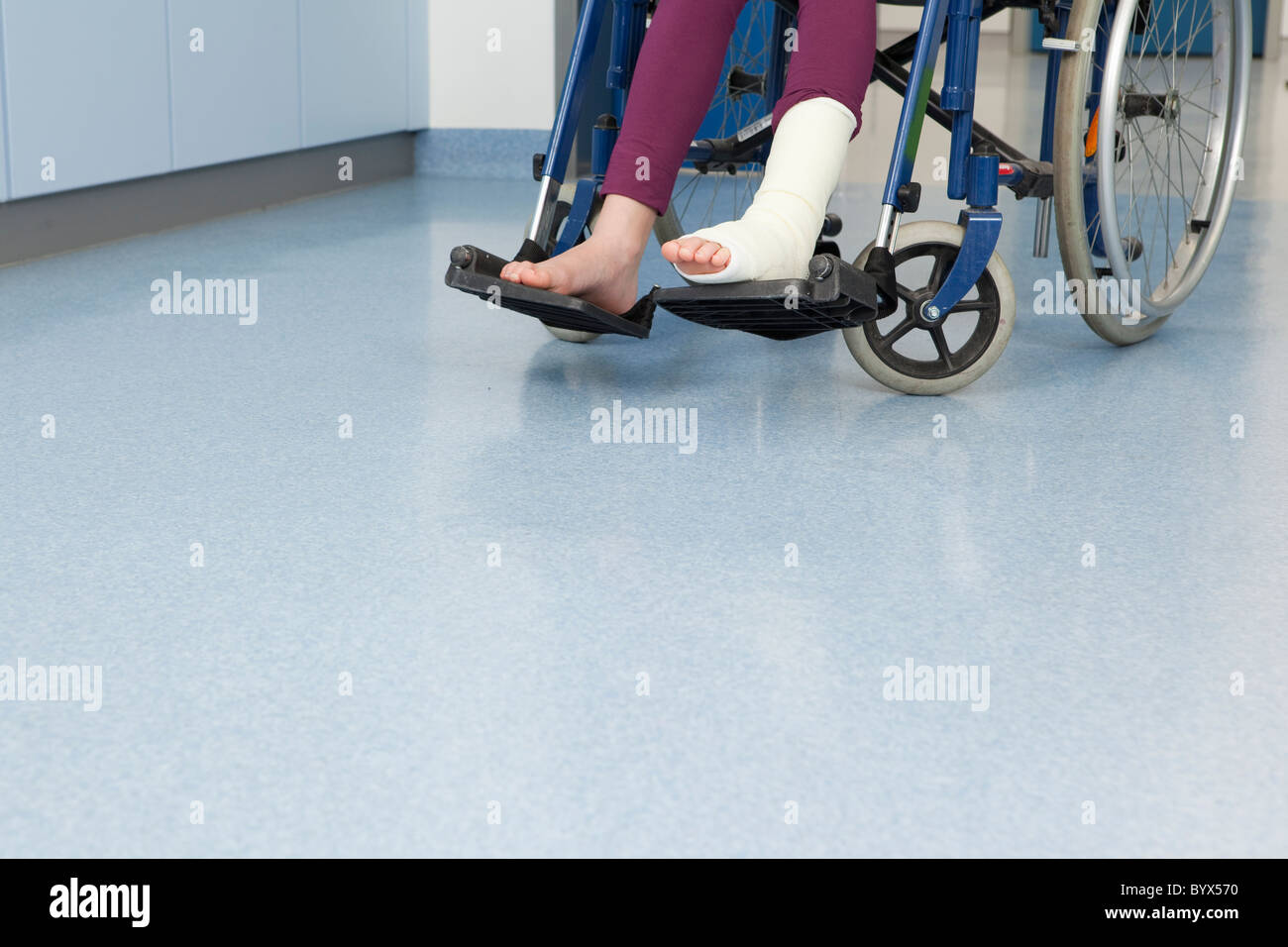 Fuß in Gips, Füße im Rollstuhl Stockfoto