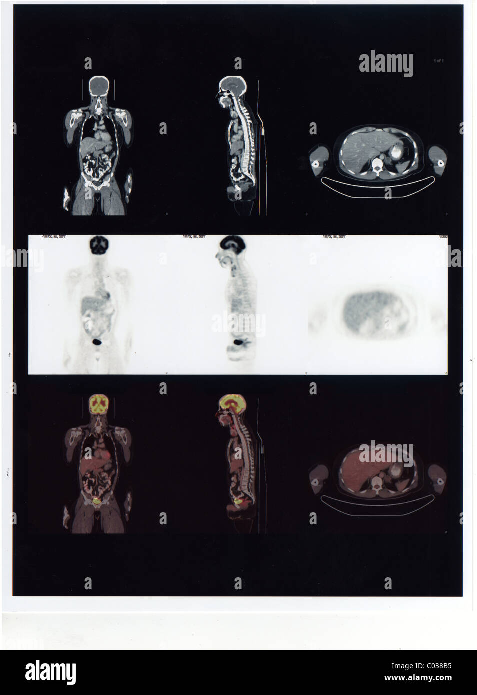 CAT-Scan der 36-jährige Hispanic männlich. Stockfoto