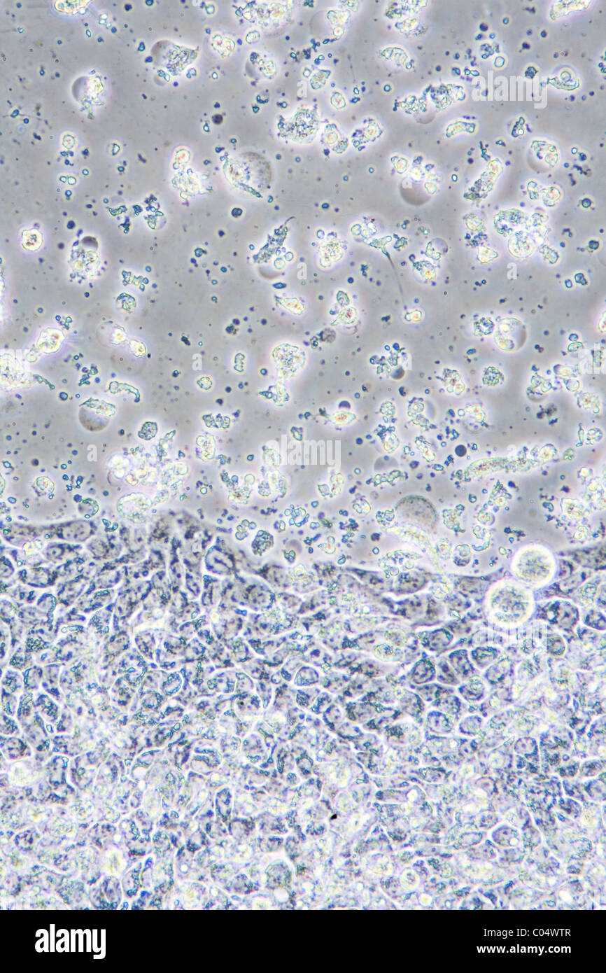 Mikroskop-Blick auf Darmkrebs Zellen in Zellkultur zeigt Wände und Kern. Stockfoto