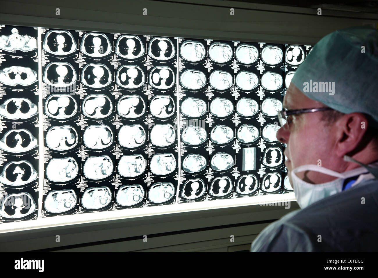 Radiologe, Arzt in einem Krankenhaus befasst sich mit CT-Aufnahmen eines Patienten. Stockfoto