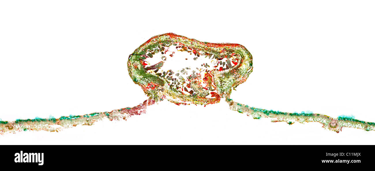 Blatt-Galle der Erle VS Eriophyes Laevis, Hellfeld Mikrophotographie Stockfoto