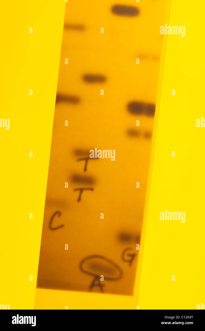 DNA-Sequenzierung. Röntgenbild eines Gels mit DNA-Nukleotidbasen (A, C, T, G) sequenziert.  Sanger Methode. Stockfoto