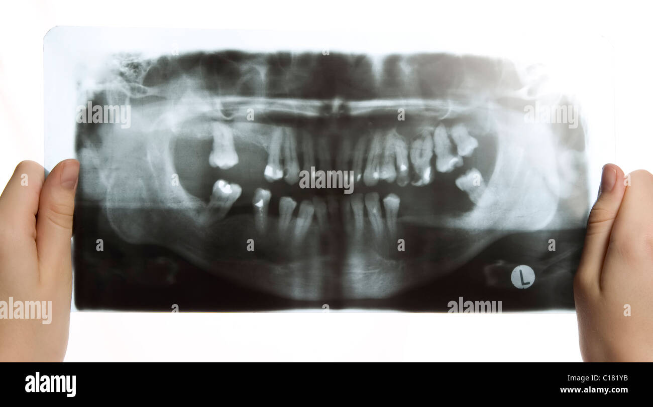 Mann hält Röntgenstrahlen Foto der Zähne Stockfoto