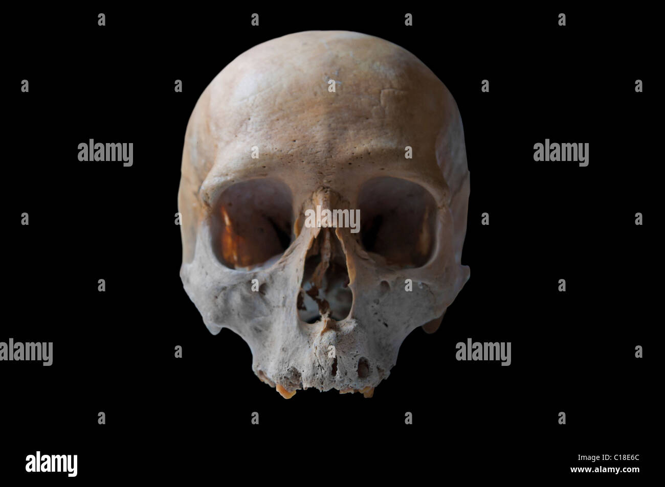 authentischen menschlichen Schädel vor Ansicht in schwarzem Hintergrund isoliert Stockfoto