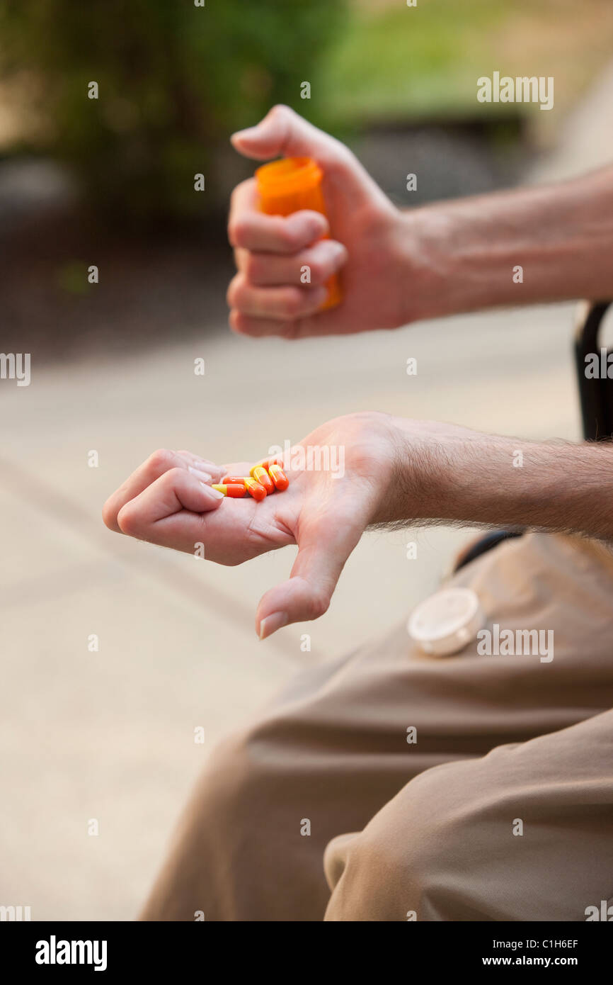 Mann mit Friedreich Ataxie Pillen mit degenerierten Händen halten Stockfoto