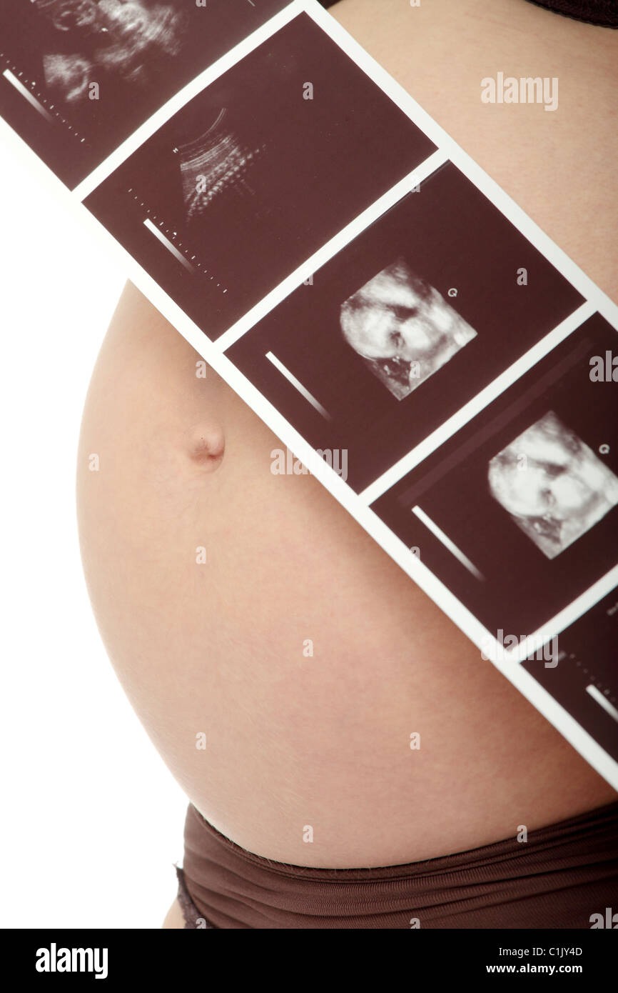 Eine schwangere Frau hält ihren Bauch und ein Foto von ihrem Ultraschall. Stockfoto
