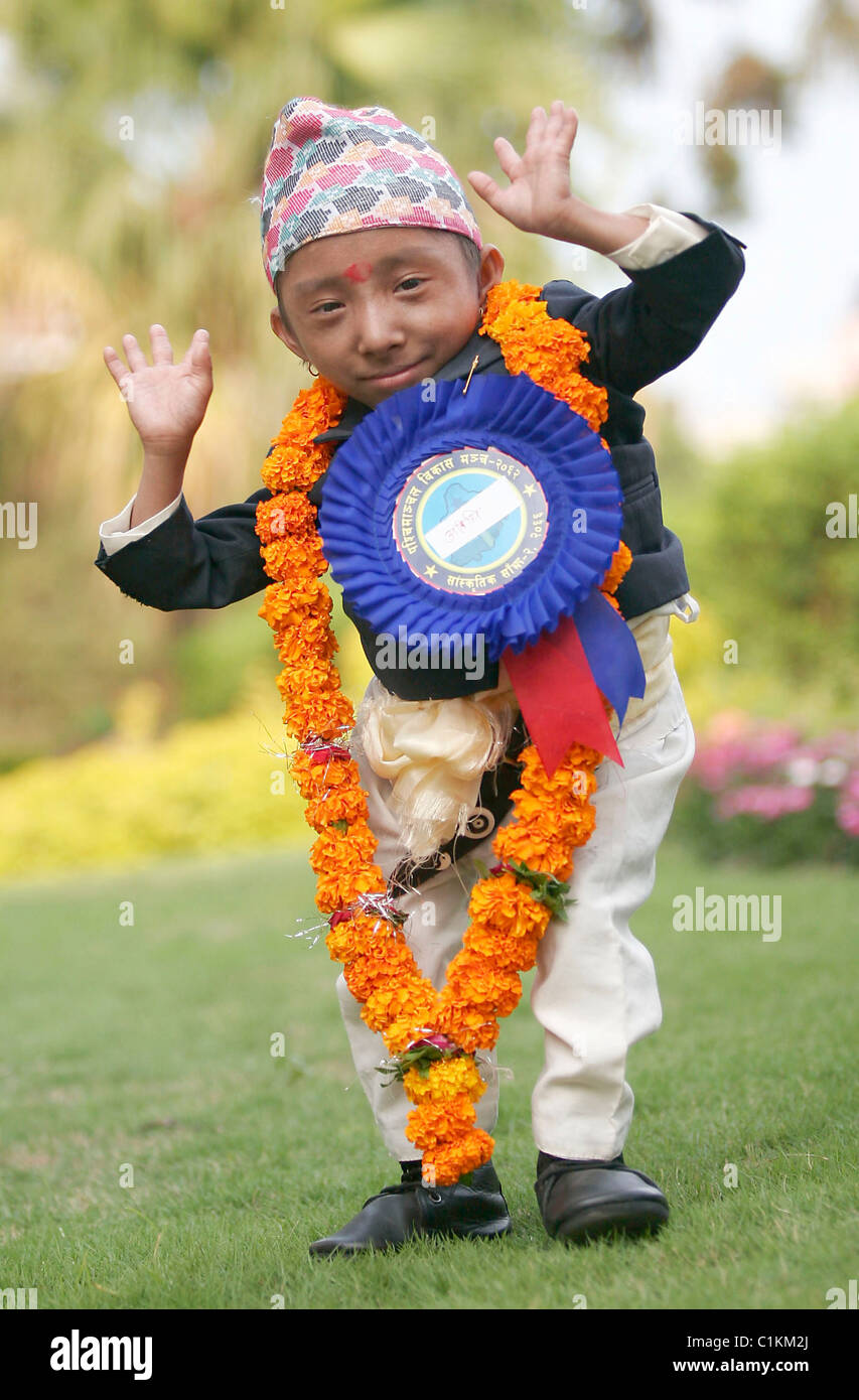 KLEINE Wunder ist das kleinste Mann der Welt? Winzige Khagendra Thapa Magar, 17, steht nur 1,6 ft (51cm) hoch und wiegt Stockfoto