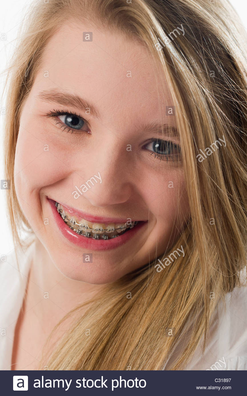 Teen Mit Zahnspange Teen Mit Zahnspange