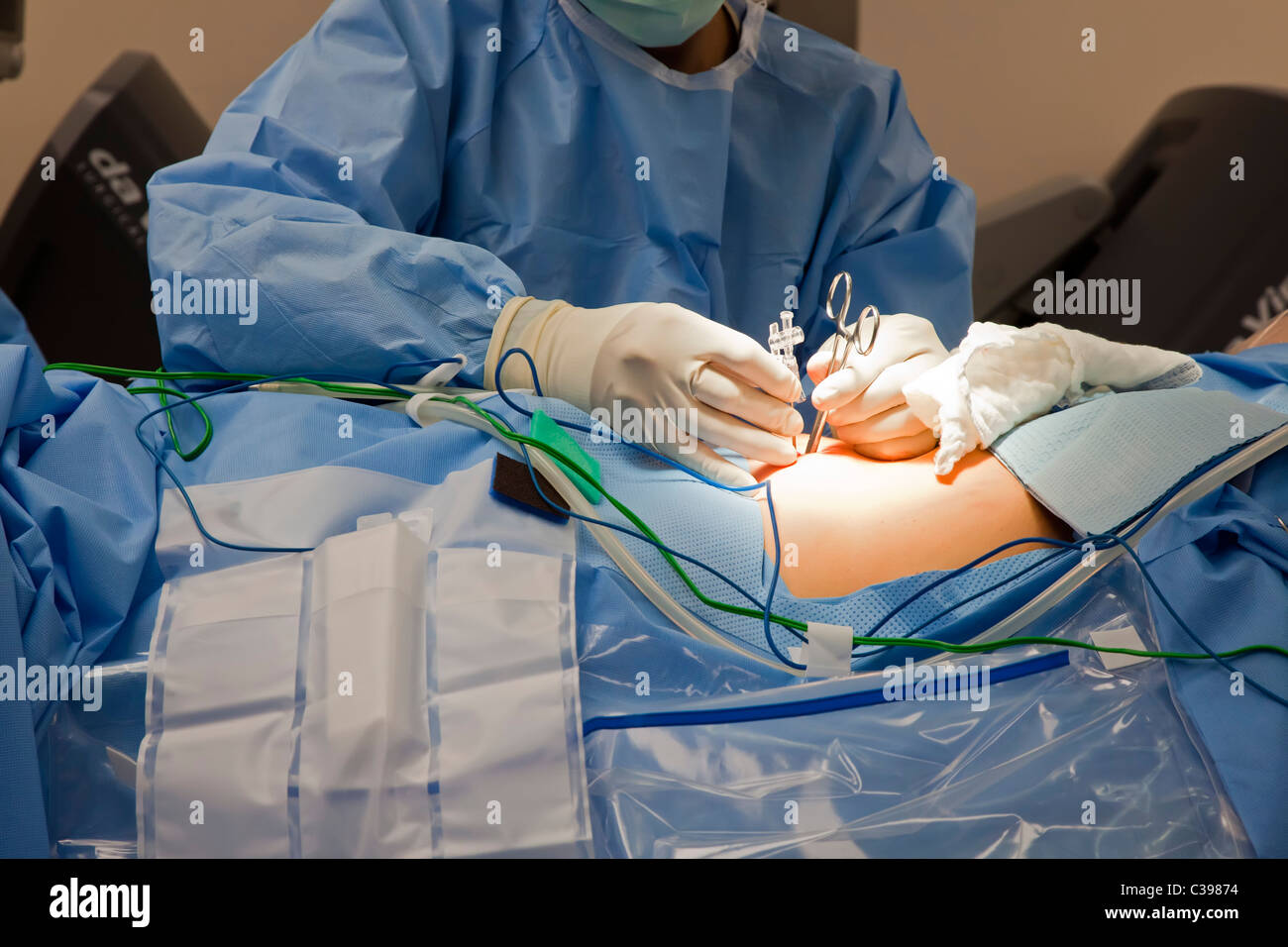 Detroit, Michigan - ein Arzt macht einen Einschnitt zur Roboter-Chirurgie im St. John Hospital ein Krebspatient Vorbereitung. Stockfoto