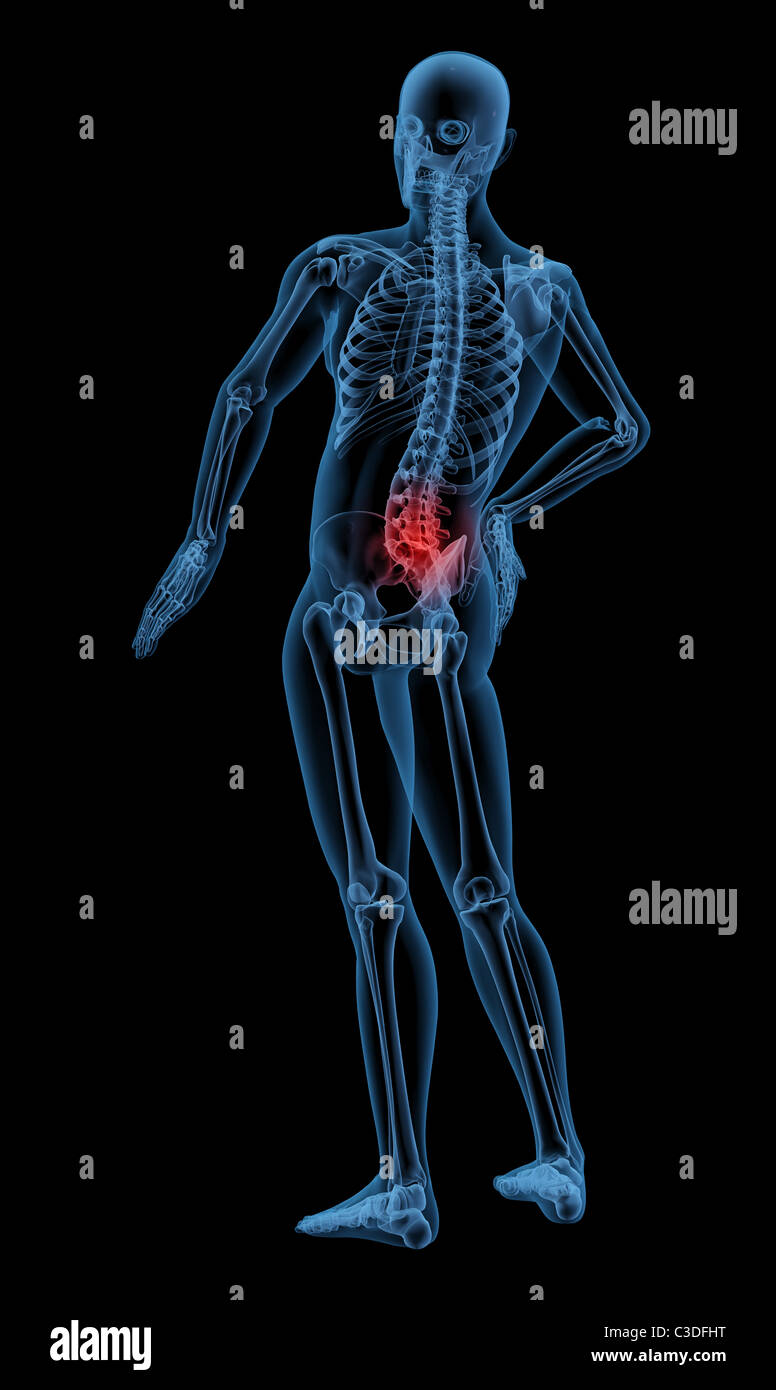 3D Rendering eines Skeletts Hervorhebung Schmerzen im Rücken Stockfoto