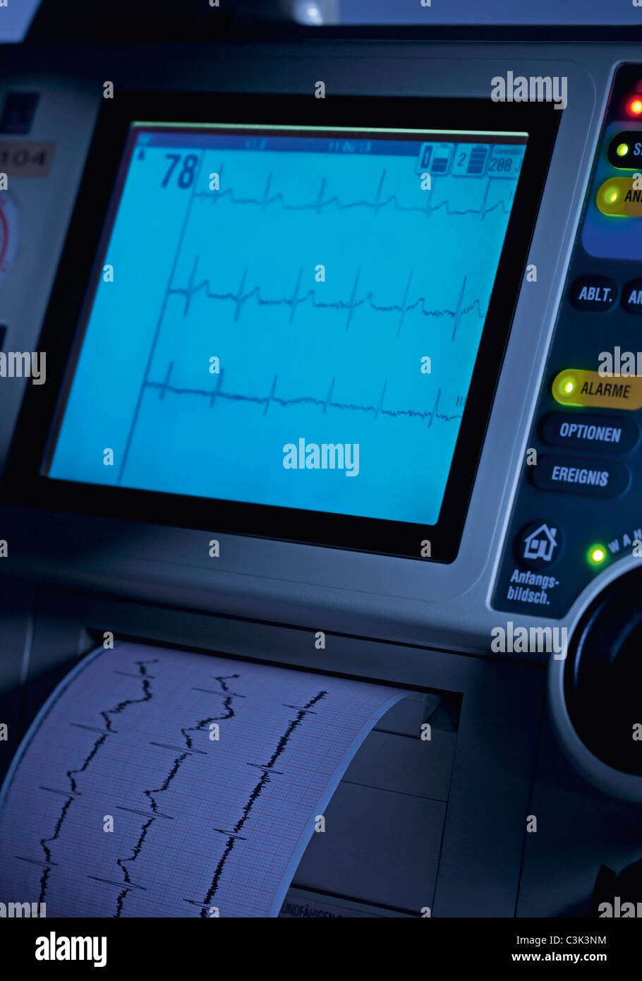 Puls und Herzfrequenz auf Monitor, Nahaufnahme Stockfoto